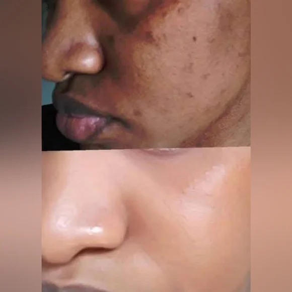 6x-Pcs Carot Face for spots,No Box - Picture 2 of 4